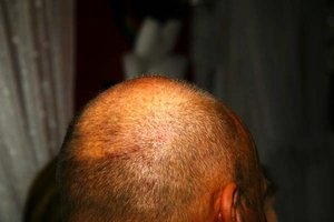 vergÃ¤nglich...die Haarpracht
